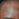 A macro shot focusing on a person's forehead just above the eyebrow. The dark-toned skin shows a distinct, fine texture of tightly packed, horizontal dehydration lines, giving it a slightly tight or parched appearance despite a faint surface sheen.