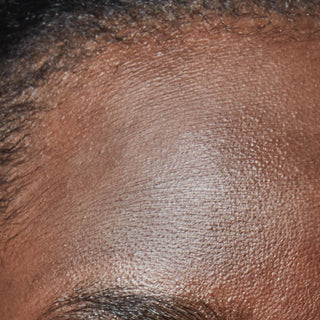 A macro shot focusing on a person's forehead just above the eyebrow. The dark-toned skin shows a distinct, fine texture of tightly packed, horizontal dehydration lines, giving it a slightly tight or parched appearance despite a faint surface sheen.