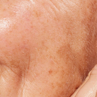 An extreme macro shot focusing on the texture of mature skin. The surface displays uneven skin tone characterized by numerous small, scattered freckles, sunspots, and larger patches of brown hyperpigmentation across the cheek and temple.