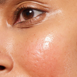 An extreme close-up of a person's mid-face, focusing on the cheek and the area under the eye. The skin has a hydrated, dewy finish, with a prominent, localized patch of pink flushing and mild irritation across the center of the cheek.