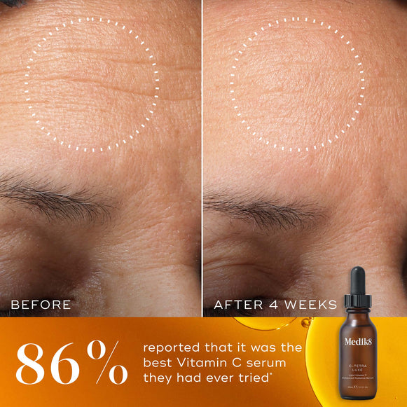 Before and after comparison of a participant’s forehead over 4 weeks, with a white dotted circle highlighting a visible reduction in the look of fine lines and wrinkles. The bottom of the image features a warm orange-gold background with a Medik8 C-Tetra Luxe serum bottle and the claim  86% reported that it was the best Vitamin C serum they had ever tried*. -hover-19