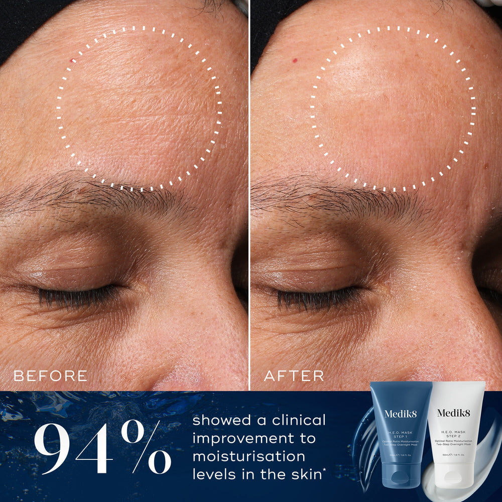 A before and after close-up comparison of a forehead, showing visibly smoother and more hydrated-looking skin in the circled area on the "After" side compared to the "Before" side. Text below states "94% showed a clinical improvement to moisturisation levels in the skin*". Tubes of Medik8 H.E.O. Mask Step 1 and Step 2 are displayed in the corner against a blue background.