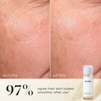 Before and after close-up of a participant’s skin on the cheek, demonstrating a smoother texture and more even appearance. The Medik8 Press & Glow tonic bottle is shown in the corner. Text highlights that  97% agree their skin looked smoother after use**. 