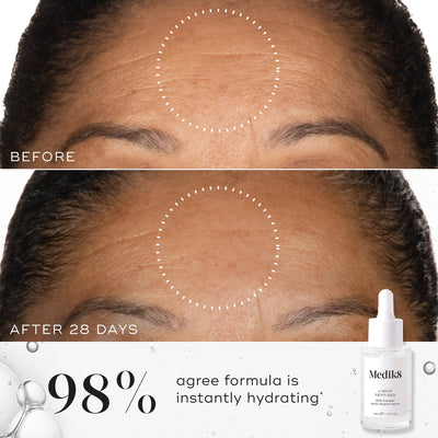After 28 days: A before-and-after close-up of a forehead, showing smoother skin in the circled area in the "After 28 Days" image compared to "Before." Text states "98% agree formula is instantly hydrating*". A bottle of Medik8 Liquid Peptides serum is displayed in the corner against a background of clear liquid bubbles.