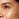 Blemishes & Enlarged Pores