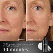 10 Min -  Before and after comparison of a participant’s face displayed next to the Medik8 Liquid Peptides Advanced MP bottle. Visuals demonstrate reduced wrinkles around the eyes and mouth. Text highlights that 100% showed clinical improvement in visible wrinkles in 10 minutes.