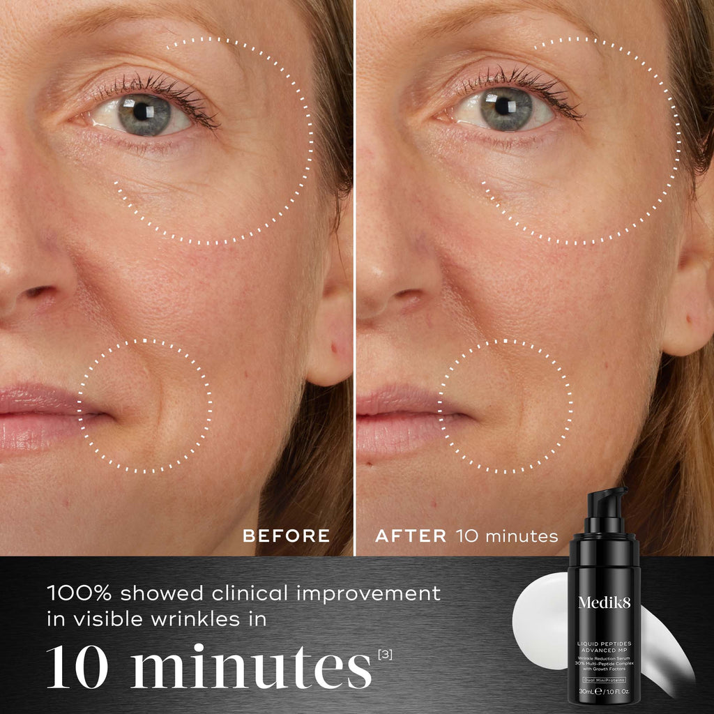 10 Min -  Before and after comparison of a participant’s face displayed next to the Medik8 Liquid Peptides Advanced MP bottle. Visuals demonstrate reduced wrinkles around the eyes and mouth. Text highlights that 100% showed clinical improvement in visible wrinkles in 10 minutes.