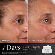 Before and after comparison of a participant’s eye area over 7 days displayed next to the Medik8 Advanced Pro-Collagen+ Peptide Cream jar. Text highlights that the product is proven to visibly reduce the depth of wrinkles in 7 days.
