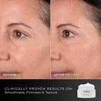 28 days - Before and after comparison of a participant’s face over 28 days displayed next to the Medik8 Advanced Pro-Collagen+ Peptide Cream jar. Text highlights clinically proven results on smoothness, firmness, and texture.