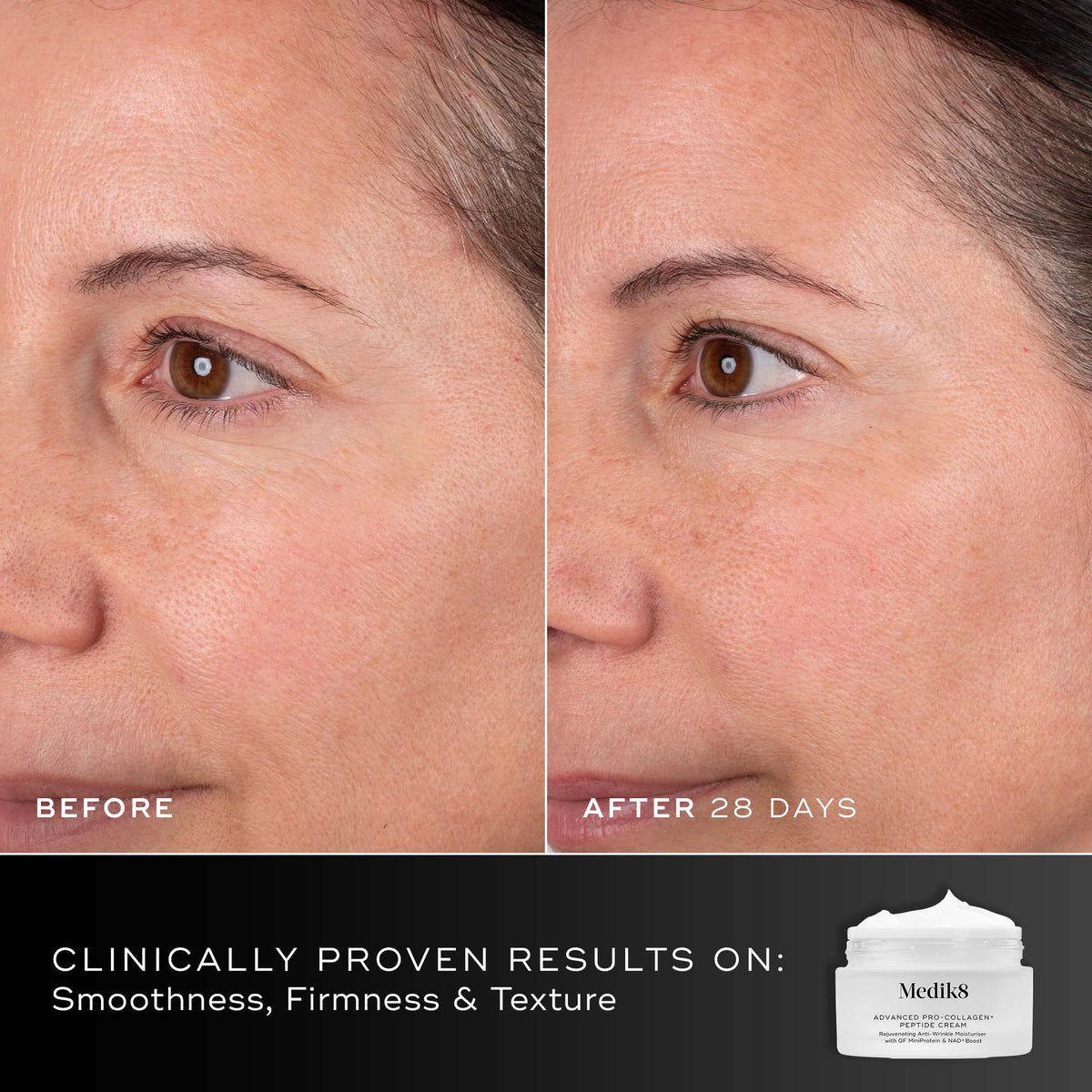 Before and after comparison of a participant’s face over 28 days displayed next to the Medik8 Advanced Pro-Collagen+ Peptide Cream jar. Text highlights clinically proven results on smoothness, firmness, and texture.