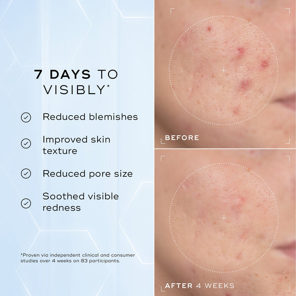 A split image showing a close-up of skin texture labelled "Before" and "After 4 Weeks," highlighting improvements. Text on the left lists benefits: "Reduced blemishes," "Improved skin texture," "Reduced pore size," and "Soothed visible redness."