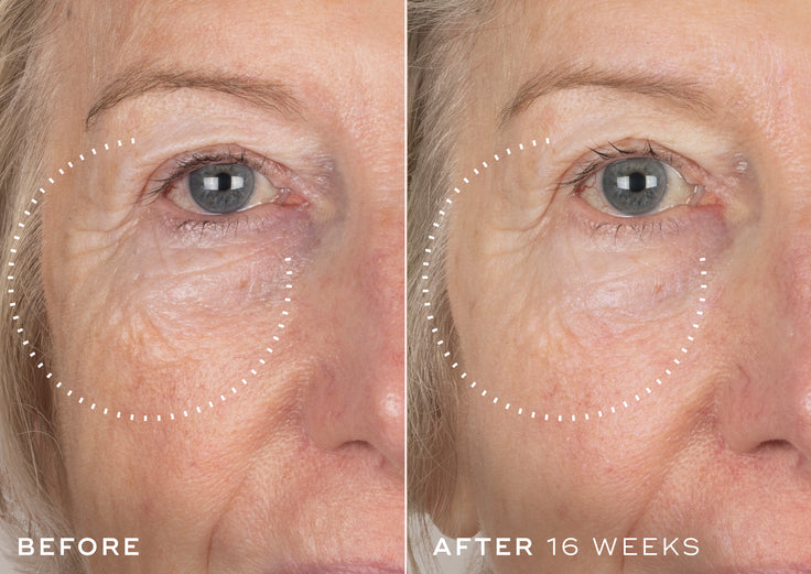 A side-by-side clinical comparison focusing on a person's right eye area to show anti-aging results. The left panel is labeled "BEFORE" and shows pronounced crow's feet, wrinkles, and textured skin under the eye outlined by a dotted white circle. The right panel is labeled "AFTER 16 WEEKS" and displays the same area outlined by a dotted white circle, showing visibly smoother skin texture with reduced depth of lines and wrinkles.