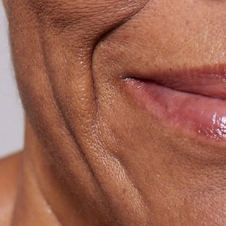 An extreme cropped close-up of the lower half of a person's face, focusing on the corner of the mouth and cheek. The dark-toned skin shows visible deep nasolabial folds, laugh lines, and a loss of elasticity, highlighting skin firmness and sagging concerns.