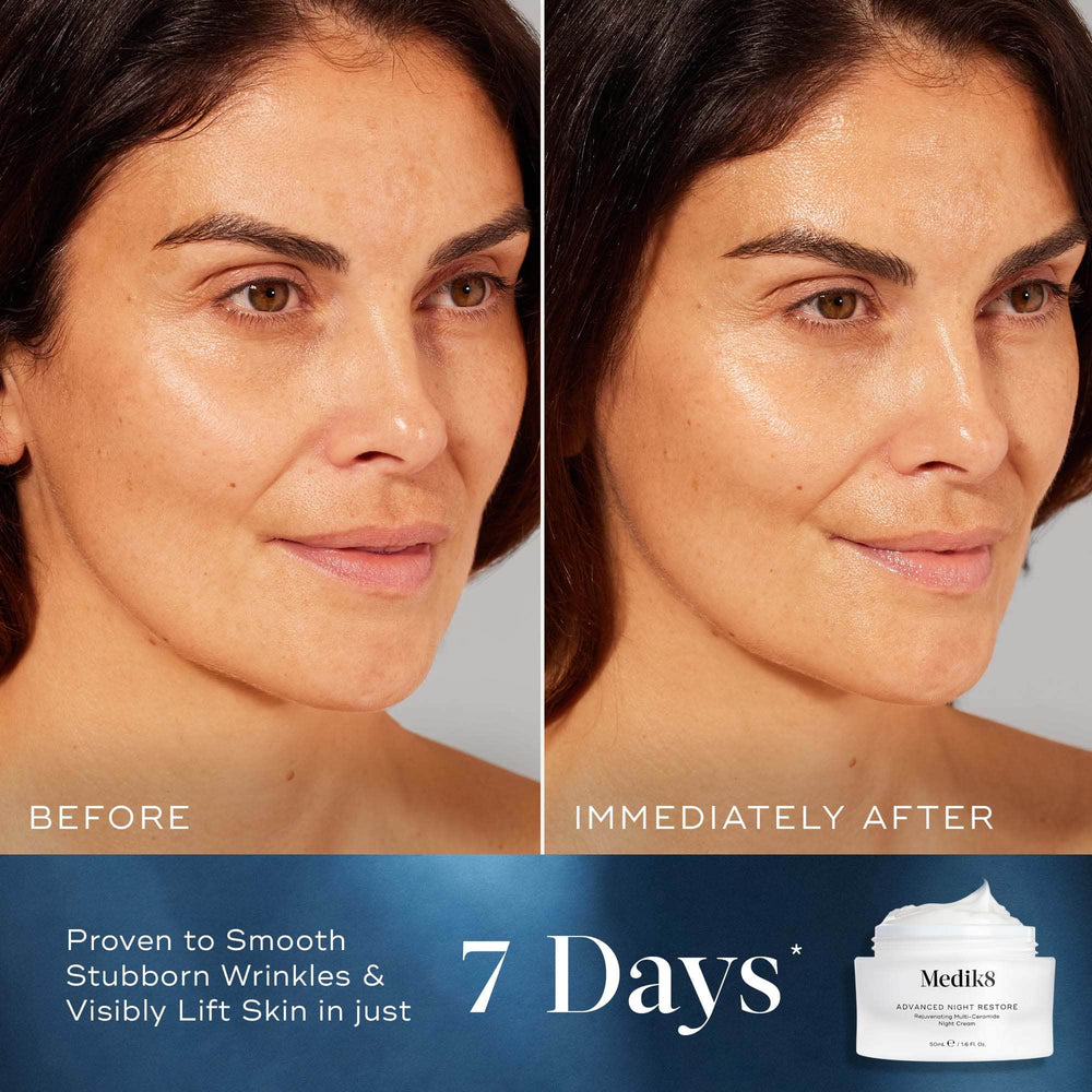 Side-by-side comparison of a woman's face labelled  Before  and  Immediately After,  showing increased radiance and hydration. Text at the bottom states  Proven to Smooth Stubborn Wrinkles & Visibly Lift Skin in just 7 Days*. 