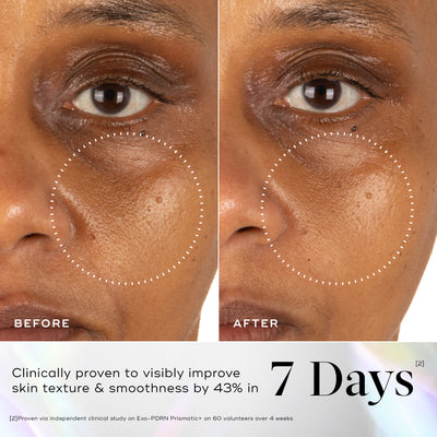 Before and after comparison of a person's under-eye and cheek area, with a dotted circle highlighting improved skin texture. Below, text states it is clinically proven that skin appears visibly smoother and softer by 43% in 7 days.